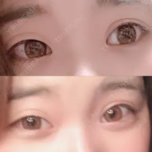 湘南美容クリニック 湘南美容クリニック 宇都宮院口コミ