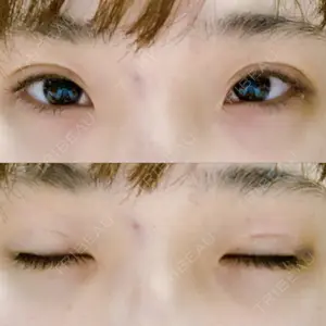 TCB東京中央美容外科 TCB東京中央美容外科 心斎橋筋院口コミ