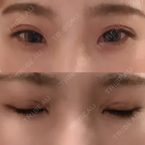 TCB東京中央美容外科 TCB東京中央美容外科 心斎橋筋院口コミ