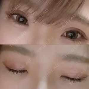 TCB東京中央美容外科 TCB東京中央美容外科 心斎橋筋院口コミ