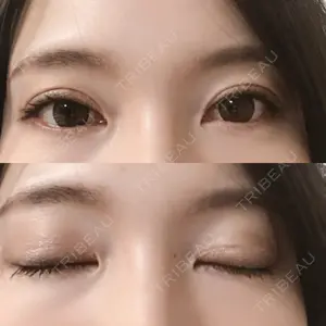口コミ