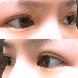 TCB東京中央美容外科 TCB東京中央美容外科 心斎橋筋院口コミ