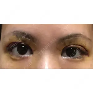 RG整形外科（旧リオン整形外科）口コミ