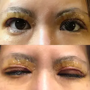 RG整形外科（旧リオン整形外科）口コミ