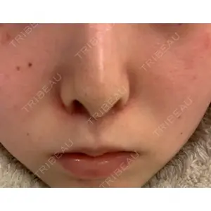 B-LINE CLINIC B-LINE CLINIC 池袋院口コミ