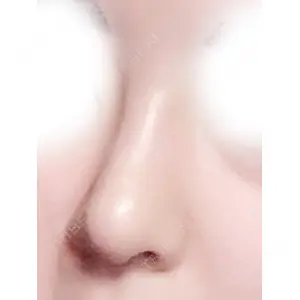 マーブル美容整形外科の