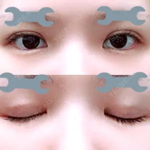 TCB東京中央美容外科 TCB東京中央美容外科 心斎橋筋院口コミ