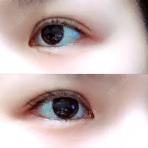 TCB東京中央美容外科 TCB東京中央美容外科 心斎橋筋院口コミ