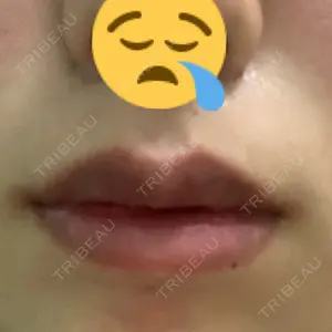 B-LINE CLINIC B-LINE CLINIC 池袋院口コミ