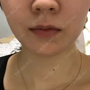 Beauty Connection Ginza Clinic（BCGクリニック）口コミ