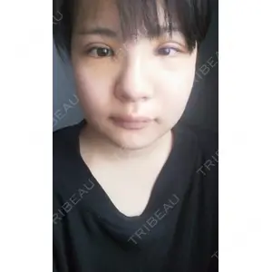 ボンディ美容整形外科（旧リオン整形外科）口コミ