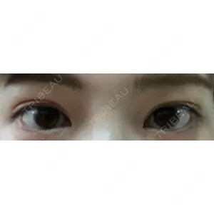 プロミス整形外科口コミ