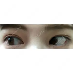 プロミス整形外科口コミ