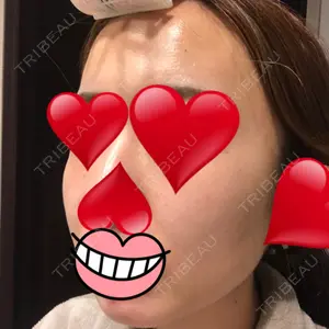ウィーバー美容外科口コミ