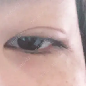 湘南美容クリニック 湘南美容クリニック 京都院口コミ