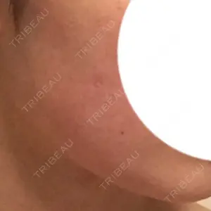 湘南美容クリニック 湘南美容クリニック 仙台院口コミ