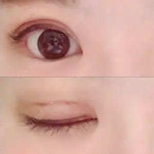 口コミ