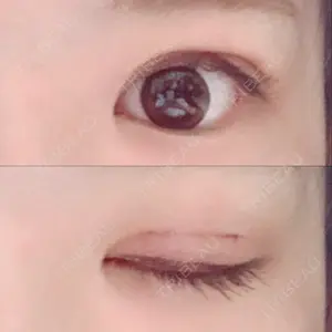 口コミ