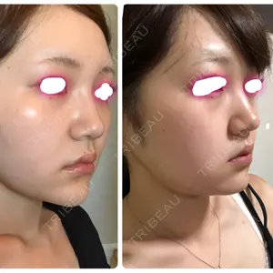 口コミ