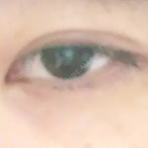 湘南美容クリニック 湘南美容クリニック 京都院口コミ