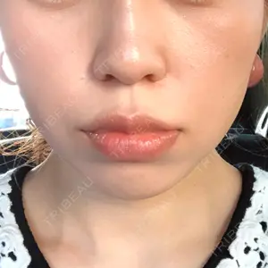 口コミ