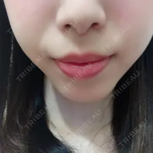 口コミ