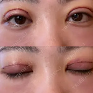 口コミ