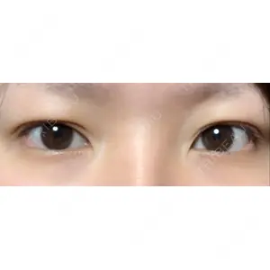 湘南美容クリニック 湘南美容クリニック 京都院口コミ