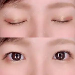 湘南美容クリニック 湘南美容クリニック 京都院口コミ