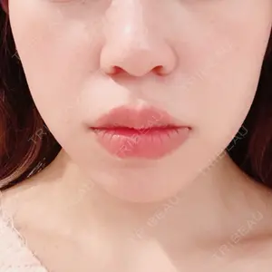 口コミ