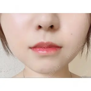 B-LINE CLINIC B-LINE CLINIC 池袋院口コミ