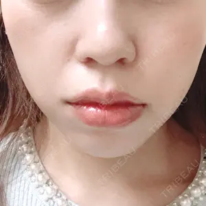 口コミ
