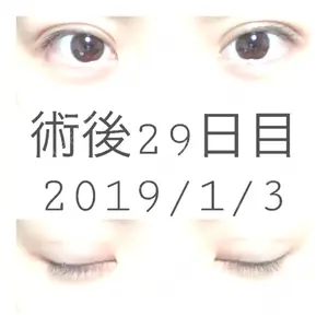 口コミ