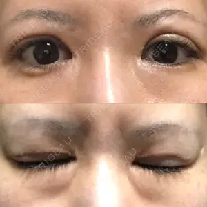 RG整形外科（旧リオン整形外科）口コミ