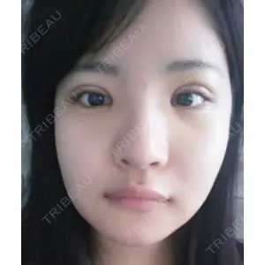 ボンディ美容整形外科（旧リオン整形外科）口コミ