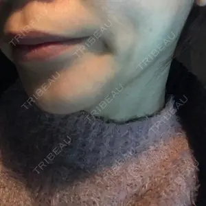 口コミ