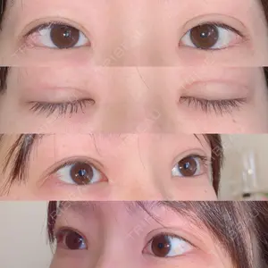 口コミ