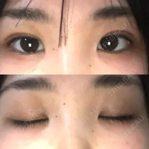 湘南美容クリニック 湘南美容クリニック 東京蒲田院口コミ