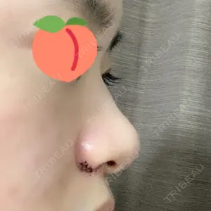 口コミ