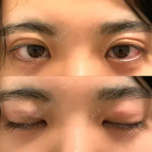 口コミ