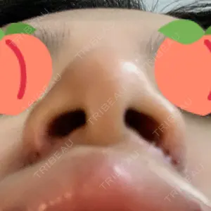 口コミ