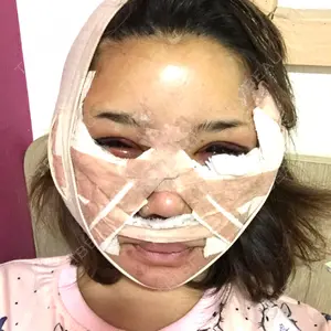 RG整形外科（旧リオン整形外科）口コミ