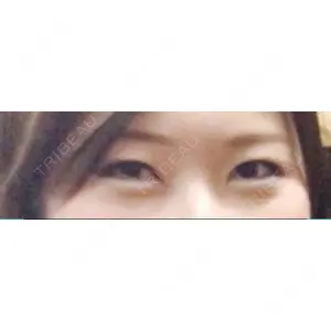 口コミ