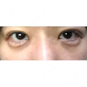 TCB東京中央美容外科 TCB東京中央美容外科 中野院口コミ