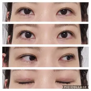 有楽町高野美容クリニック口コミ