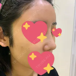 Lovelyan整形外科口コミ