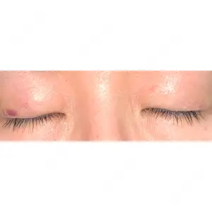 湘南美容クリニック 湘南美容クリニック 東京蒲田院口コミ