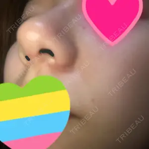 ソウルクイーン整形外科（旧コエンミ整形外科）口コミ