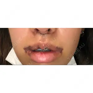 清潭女神美容外科の