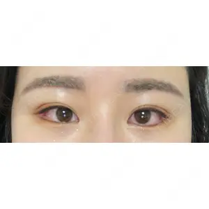 Lovelyan整形外科口コミ